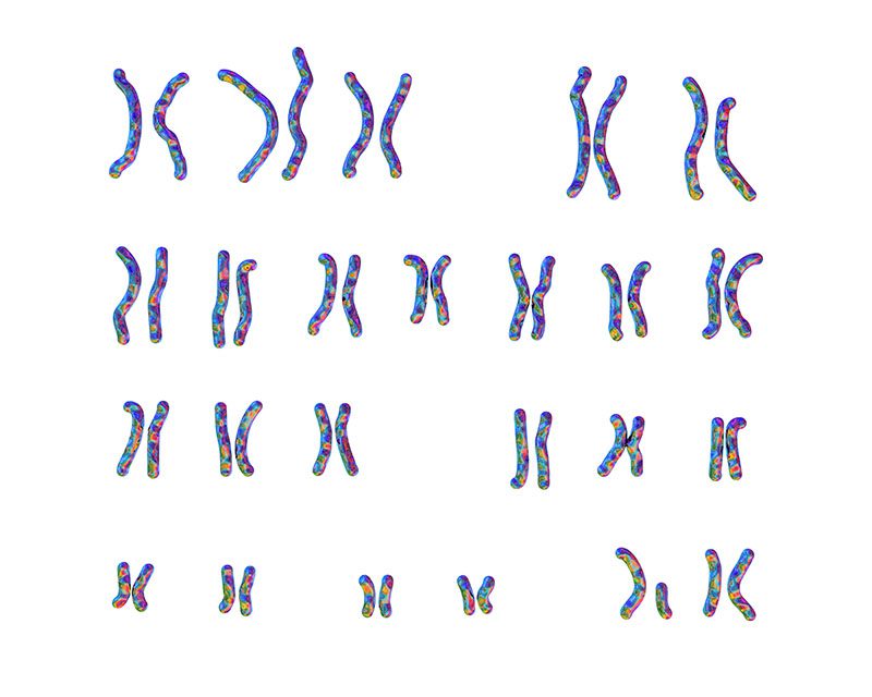 Example of Karyotype